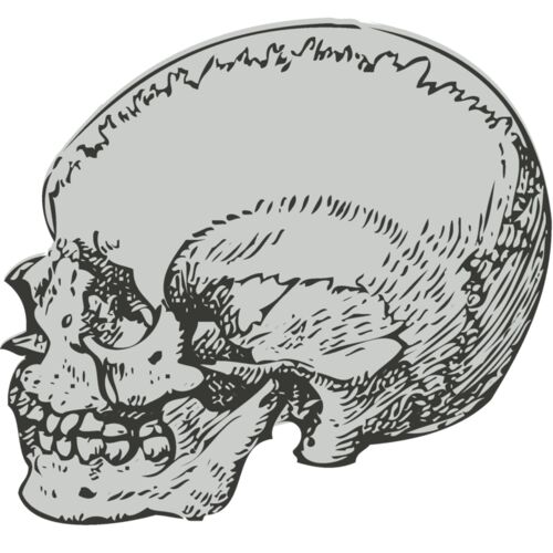 Medical Skull 5 Thumbnail