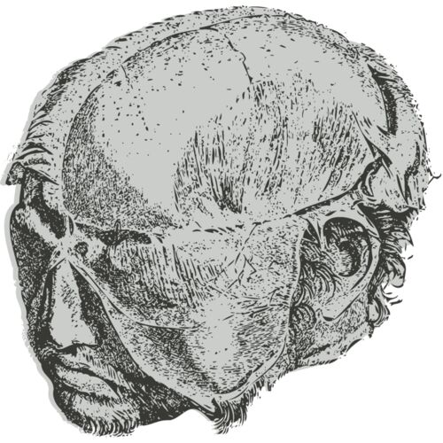 Medical Skull 14 Thumbnail